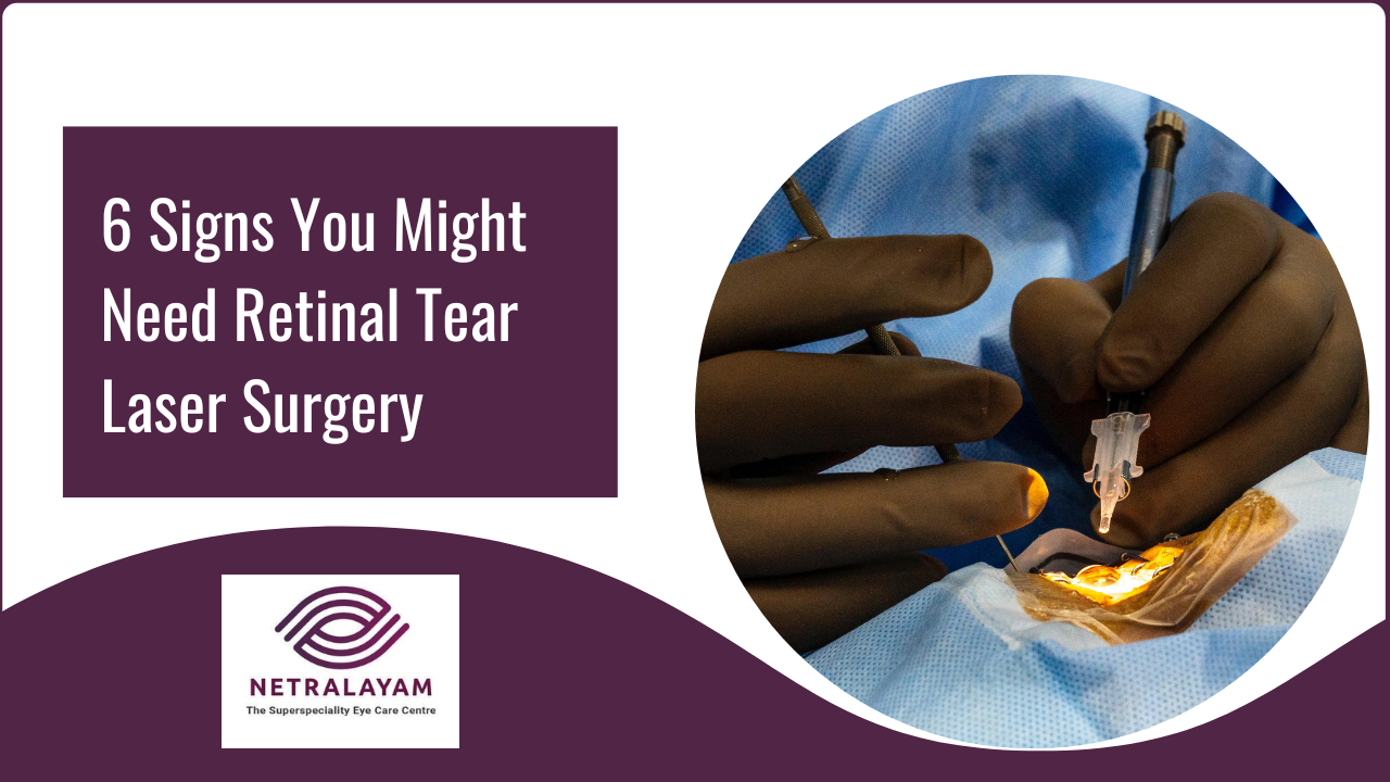 6 Signs You Might Need Retinal Tear Laser Surgery