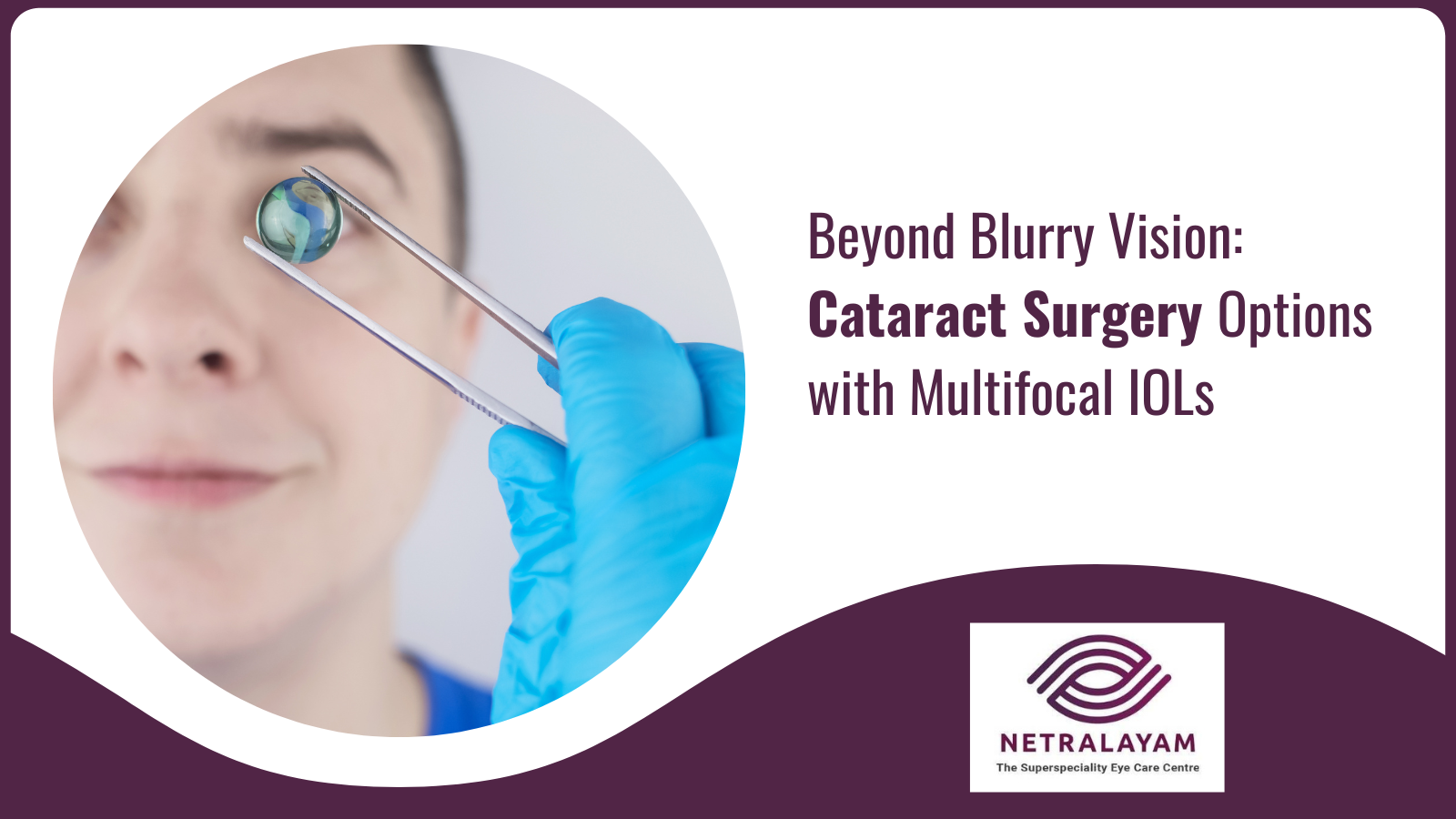 Beyond Blurry Vision: Cataract Surgery Options with Multifocal IOLs