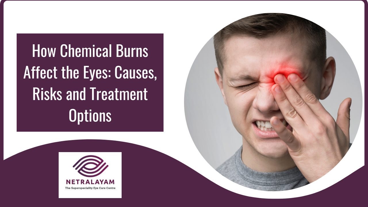 How Chemical Burns Affect the Eyes: Causes, Risks and Treatment Options