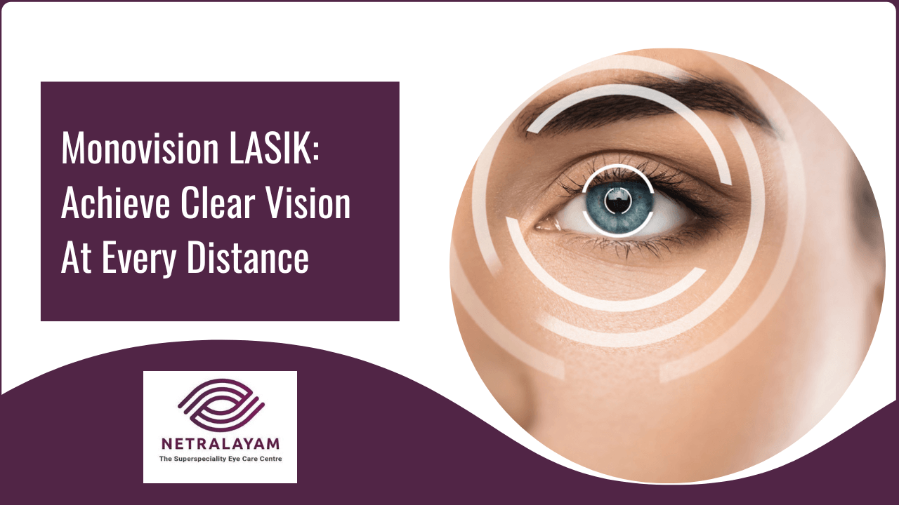 Monovision LASIK: Achieve Clear Vision At Every Distance