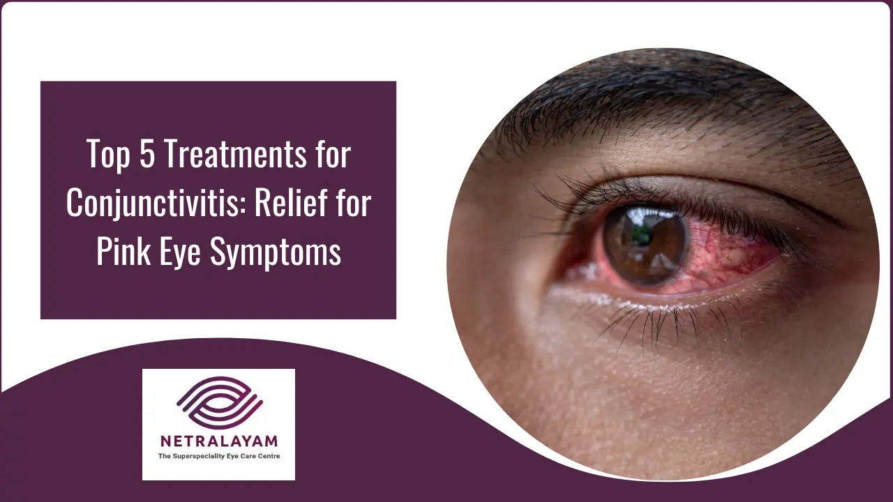 5 Effective Treatments for Conjunctivitis