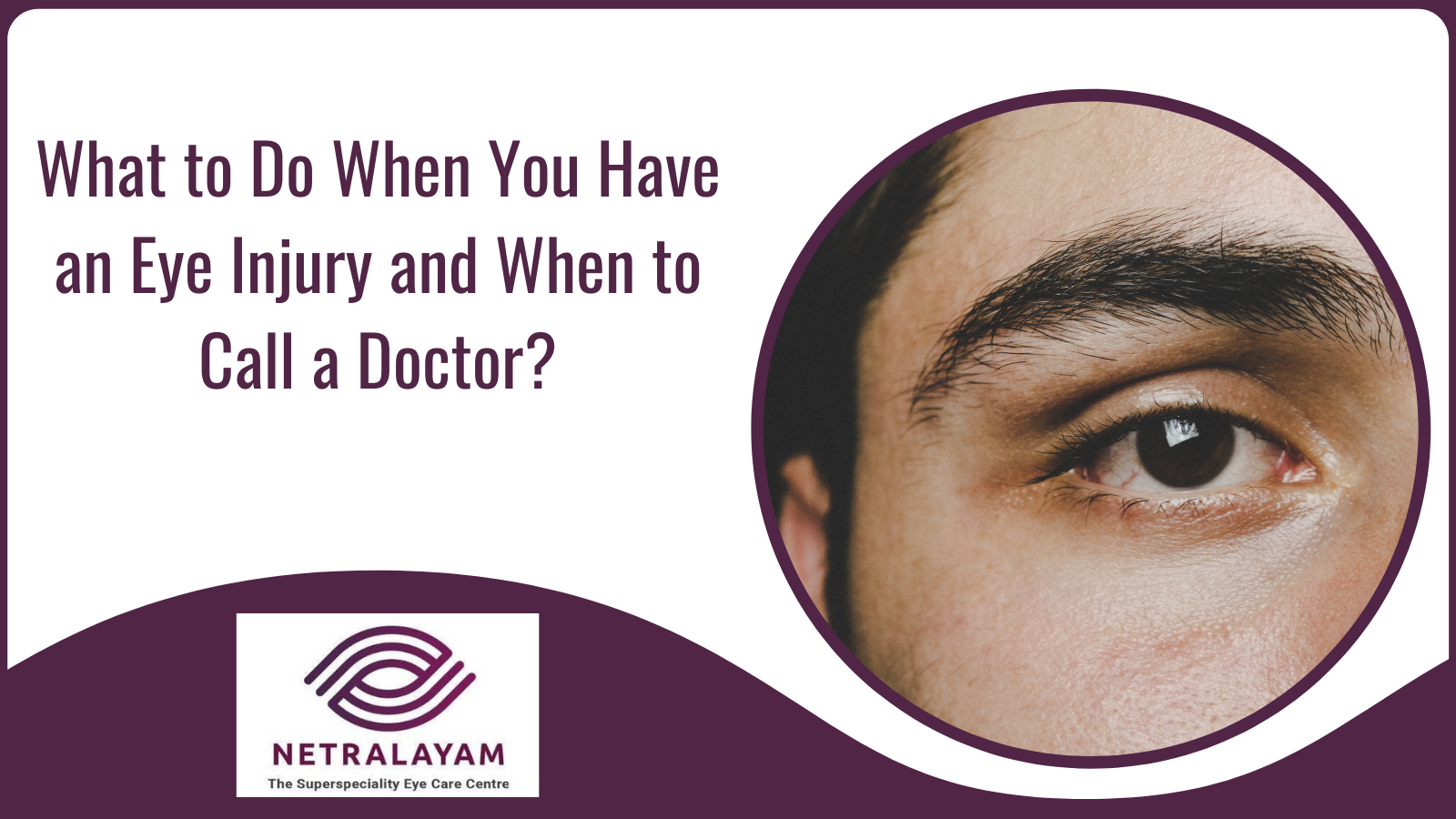 what-to-do-when-you-have-an-eye-injury-and-when-to-call-a-doctor